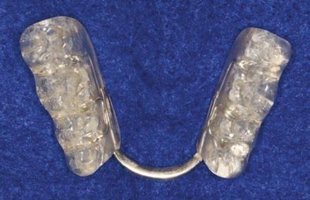 This objective can be accomplished orthodontically, restoratively and prosthetically.