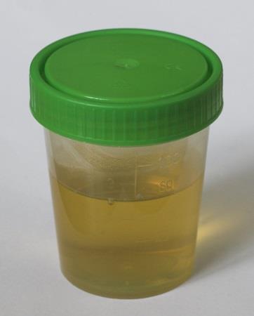 Random Facts about Urine: A nice cold drink of... urine?