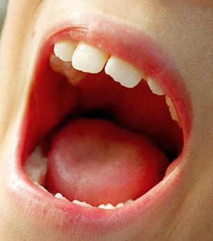 Mouth Special features: teeth, tongue, saliva Teeth Incisors