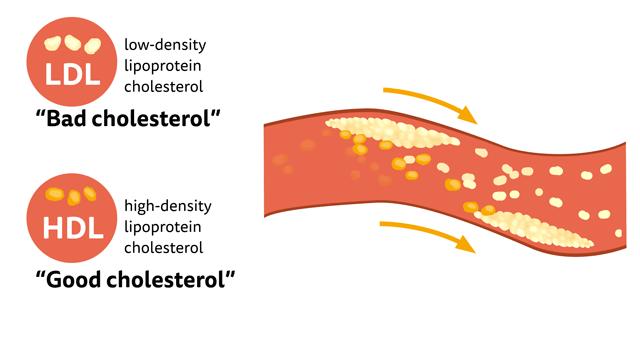 The Liver and Cholesterol Cholesterol