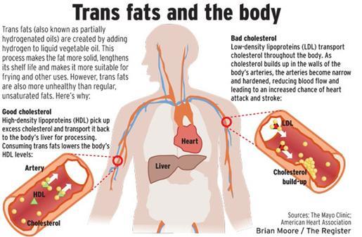 with trans fats might be more likely to develop the debilitating condition, new