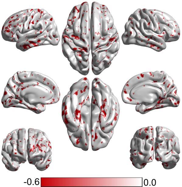 Supplementary Figure S4. Cortical atrophy patterns of the unknown subtype in the ADNI validation dataset.