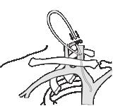 Verify correct catheter tip position using fluoroscopy or appropriated technology.