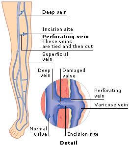 o Venae comitantes unite to form the popliteal vein, which continues