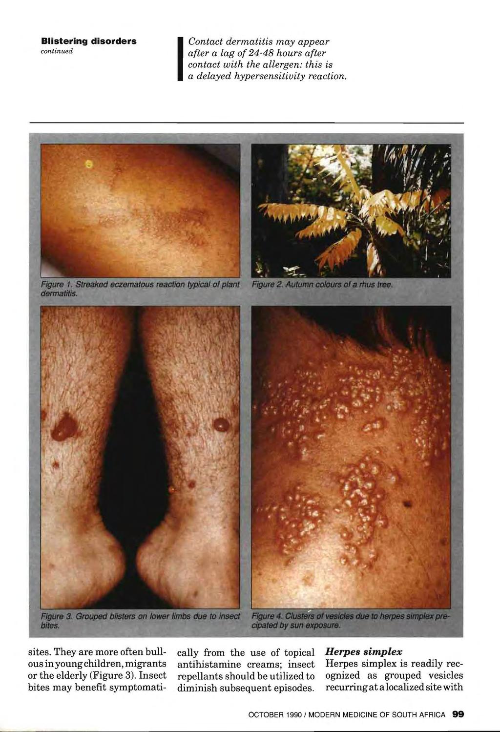 continued Contact dermatitis may appear af t e r a [ a g 0f 24-48 hours after contact with the allergen: this is a delayed hypersensitivity reaction. Figure 3.