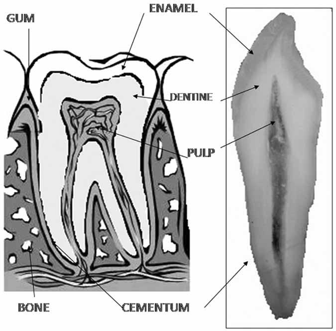 198 Recent Patents on Biomedical Engineering, 2009, Vol. 2, No. 3 Roveri et al. Fig. (1). Tooth anatomic draft: enamel (E), dentine (D), pulp (P) and cementum (C) Reproduced by permission from Ref.