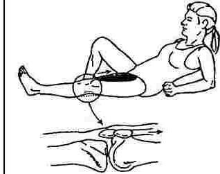 Exercise Program: QUADRICEPS SETTING - to maintain muscle tone in the thigh muscles aml straighten the knee. Lie or sit with the knee extended fully straight as in figure.
