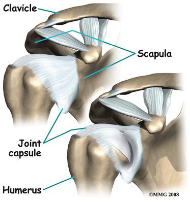 The part of the scapula that connects to the shoulder is called the acromion. A bursa is located between the acromion and the rotator cuff tendons.