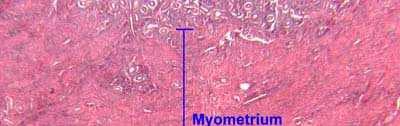 Histology of the Uterus Myometrium Three layers
