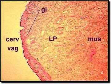 Histology of the Cervix Endocervix: Lined by simple columnar epithelium with compound racemose glands or crypts that are liable to chronic infection. It secretes alkaline cervical mucus.