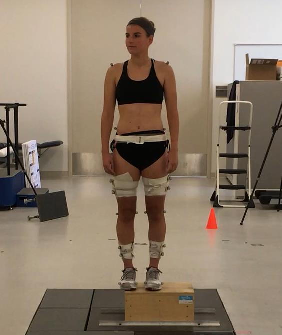 Single leg squat test/step Down (SLST) SLST valid tool to screen for NM deficits associated with knee valgus and LE