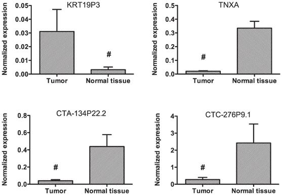 1200 ZHU et al: BLADDER CANCER-ASSOCIATED lncrnas A B C D Figure 2. Confirmation of (A) KRT19P3, (B) TNXA, (C) CTA 134P22.2 and (D) CTC 276P9.1 lncrna levels by quantitative PCR (qpcr).
