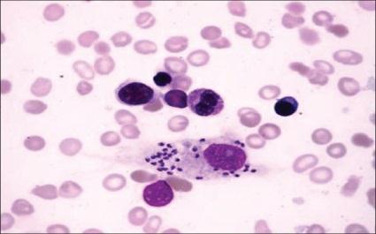 Leishmania itself has many species that are morphologically identical and it is extremely difficult to differentiate between the different types.