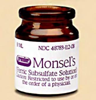 Reactions to Monsel Solution Monsel solution is ferric subsulphate solution, used as a styptic for minor surgical