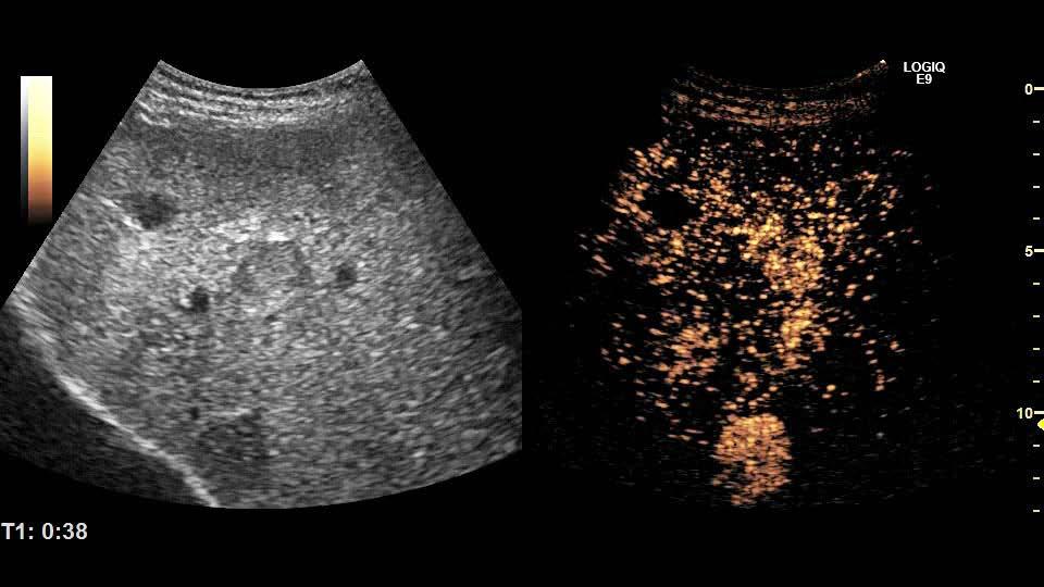 Ultrasound/Ultraschall in der Medizin [3,4].