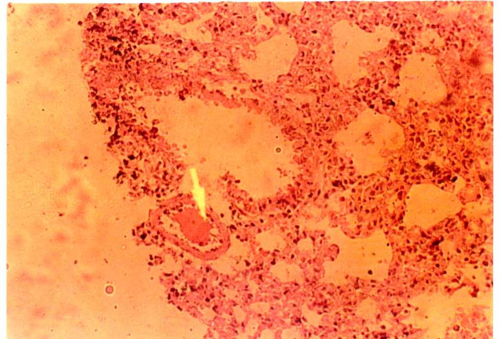 normal architecture (H&E Stain, 100) Figure 6: The lung section of
