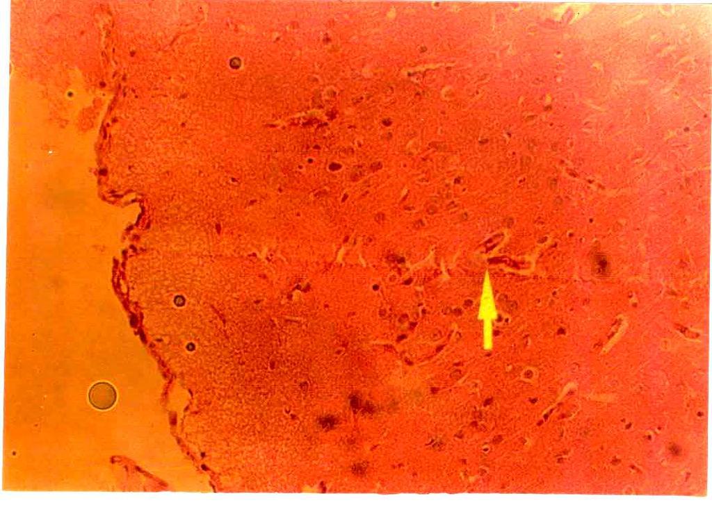 (H&E Stain, 400) Figure 13: The heart section of rats dosed 50mg/kg and 100mg/kg