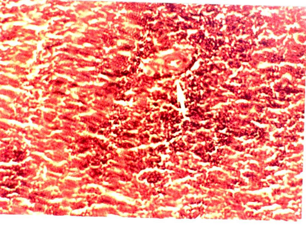 DISCUSSION Figure 18: Splenic section of rats that received 50 mg/kg wt showing vascular congestion and follicular disorganization (H&E Stain, 100) A.