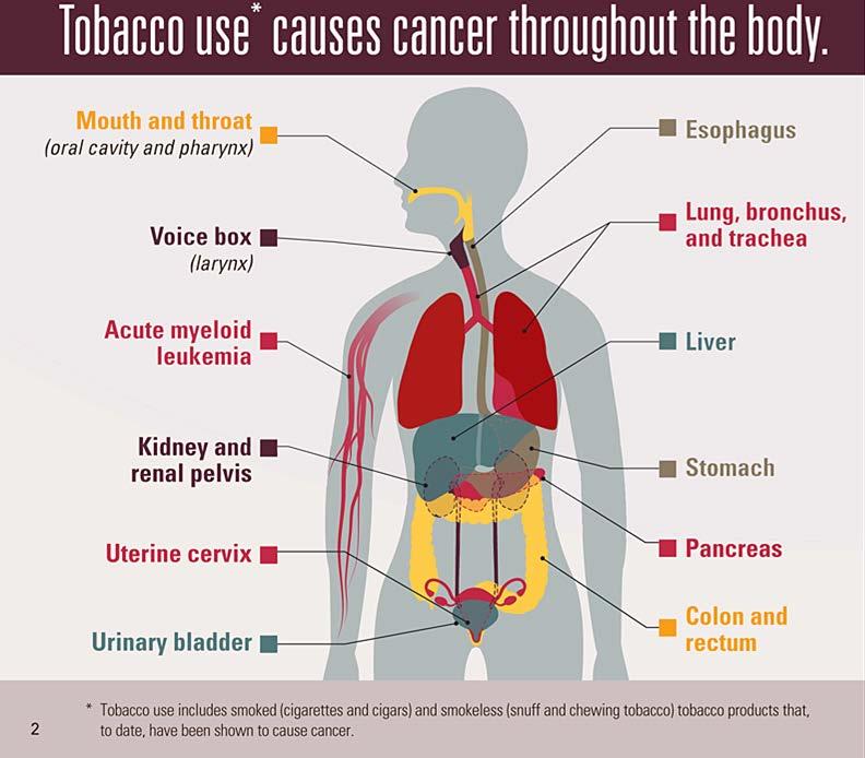 Commercial Tobacco Use and Cancer