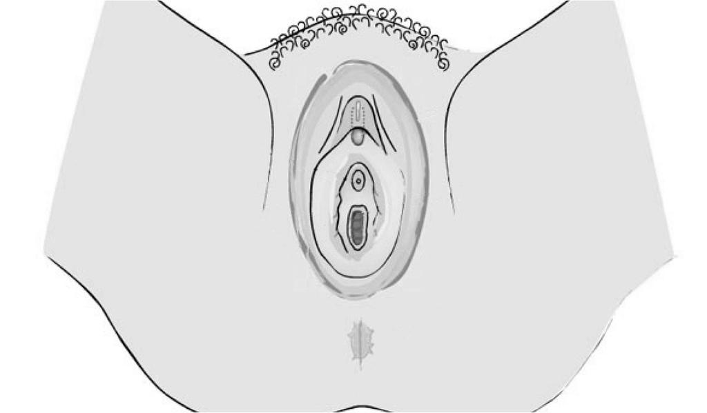 Cervix Fallopian Tubes Ovaries Uterus Cervix Vagina