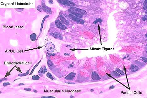 Unicellular gland DNES (Diffuse
