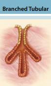Simple Branched Tubular Example Glands in the uterus and stomach This means simple