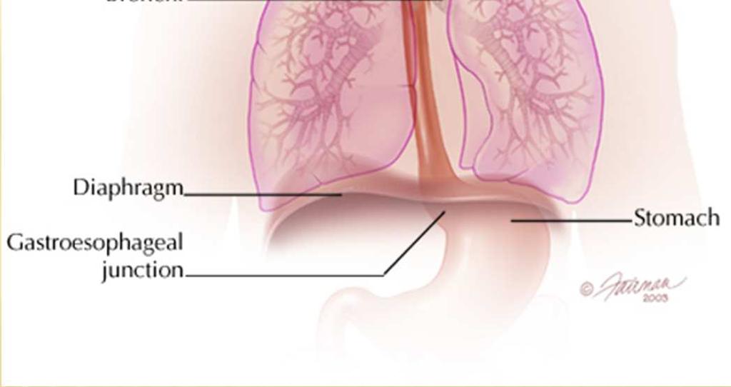 stomach Esophageal wall layers