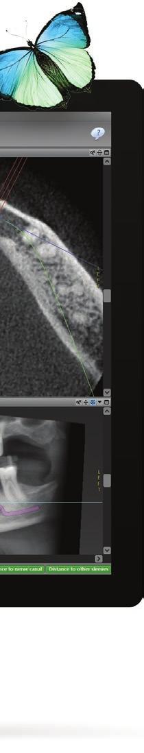 The open interfaces ensure compatibility with all (CB) CT, intraoral, model & impression scanners, and open CAD/CAM