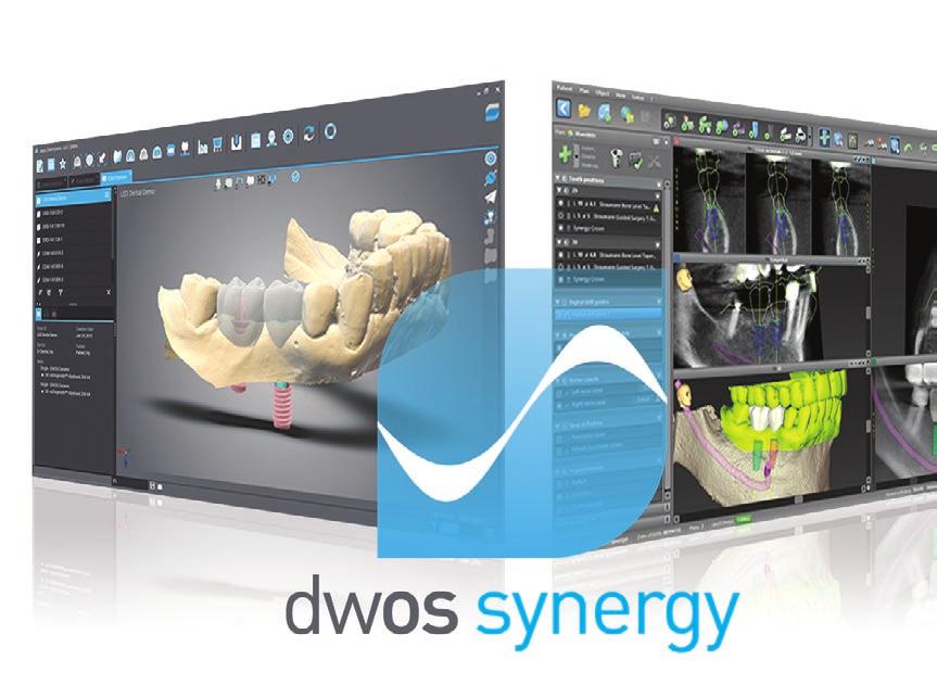 DWOS SYNERGY - PROSTHETIC-DRIVEN BACKWARD PLANNING DWOS Synergy, our integrated planning