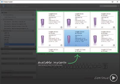 instructions and intuitive guidance to the dental professional within the codiagnostix user interface and whilst they are working with