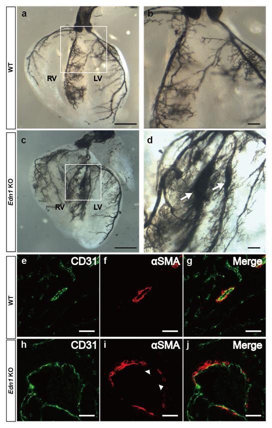Supplementary Figure S1 Enlarged coronary artery branches in Edn1-knockout mice. a-d, Coronary angiography by ink injection in wild-type (a, b) and Edn1-knockout (Edn1-KO) (c, d) hearts.