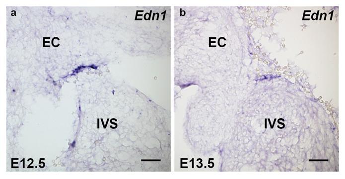 Supplementary Figure S10 Edn1 expression in developing interventricular septum.
