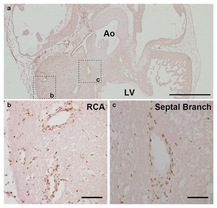 Supplementary Figure S13 Proepicardium-derived cells contribute to the septal branch. Quail proepicardium was orthotopically grafted to the chick heart.