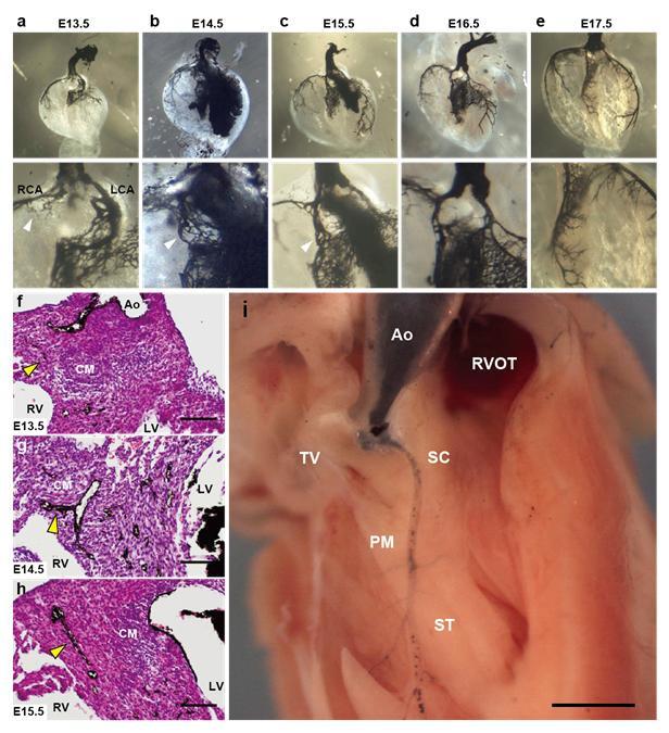 Supplementary Figure S3 Serial observation of coronary artery formation in wild-type mice. a- e, Coronary angiography in mouse developing hearts. Each magnified image is depicted in the lower panel.