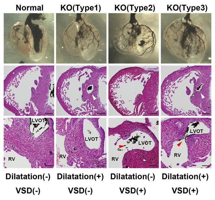 Supplementary Figure S5 Combinations of the septal branch dilatation and the ventricular septal defect in Ednra-knockout mice. At the E17.