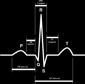 ECG waves: A P wave that represents atrial systole (atrial depolarization) A QRS complex that represents