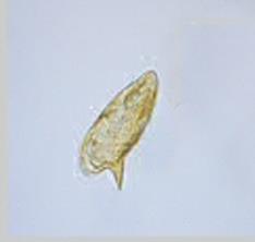 Schistosoma Mansoni.