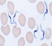 B. INSIDE RED BLOOD CELLS TRYPANOSOMIASIS AFRICAN SLEEPING SICKNESS TRYPOMASTIGOTES