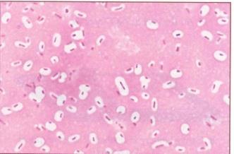 RED CAPSULE STAIN (NOTE 3 BACTERIA which has this structure ) singular: bacterium KLEBSIELLA PNEUMONIAE Streptococcus pneumoniae CAPSULE PRIMARY PNEUMONIA Capsule is composed of mucoid