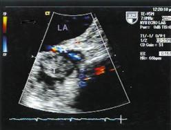 Fig. 1 Source: Journal of the American Society of Echocardiography 2001;