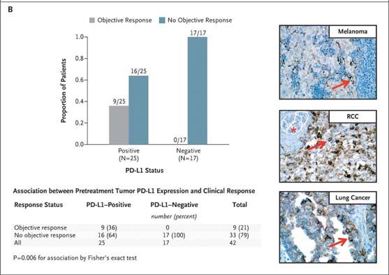 PD L1 as a Predictive Marker: Response Based on
