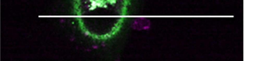 HeLa cells transfected with plasmids