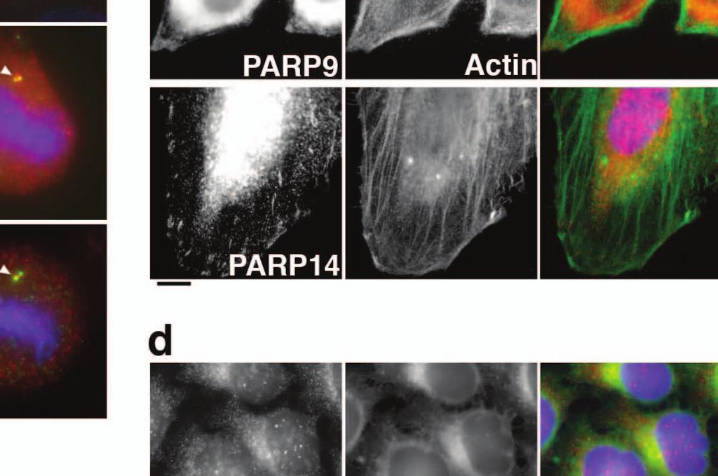 B) Interphase HeLa cells were stained with antibodies against PARP12 and the trans Golgi marker
