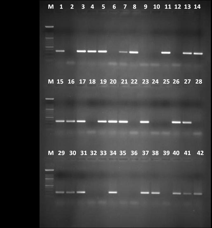 Linija 1 M DNA marker, linije 1,15, 29 pozitivna kontrola (CCUG 17874), linije 3-5, 11, 13, 14, 16, 17,19-21, 23, 26, 27, 30, 31, 34, 37, 38, 40-42 pozitivna amplifikacija