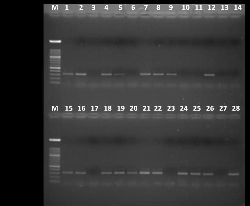Linija 1 M - DNA marker, linije 1,15 pozitivna kontrola (CCUG 17874), linije 2, 4, 5, 7, 8, 9, 12, 16, 18, 19, 20, 21, 22, 24, 25, 26, 28 pozitivna amplifikacija caga2