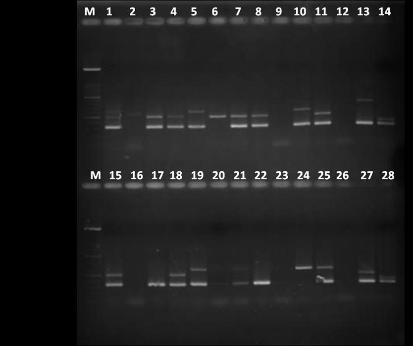 Linija 1 M DNA marker, linije 14, 28 pozitivna kontrola (CCUG 17874) za cage, linije 1, 3, 4, 5, 7, 8, 10, 11, 13 pozitivna amplifikacija CagE (329 bp); linije 14, 28 negativna kontrola za caga3,