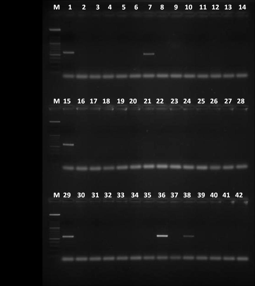 Linija 1 M DNA marker, linije 1, 15, 29 pozitivna kontrola (CCUG 17874), linije 7, 36, 38 pozitivna ampflikacija tnpa (569 pb) CCUG Culture
