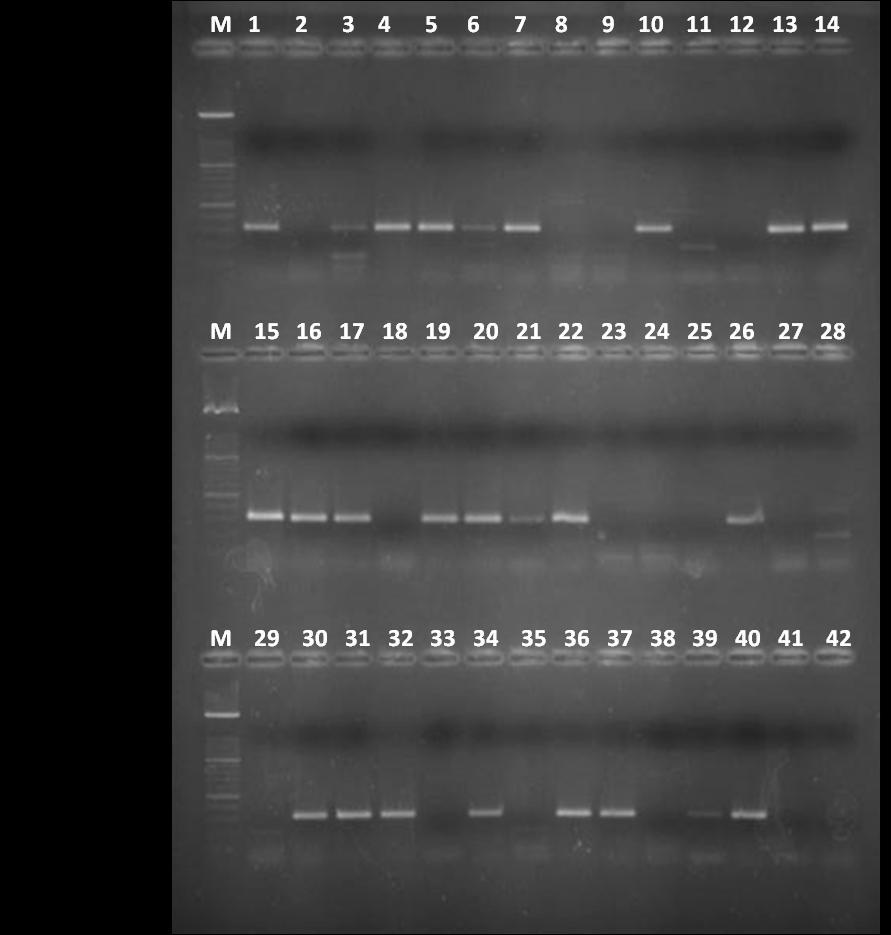 5.9. DupA gen u Helicobacter pylori izolatima 5.9.1. Učestalost dupa gena PCR metodom detektirano je 35 (34.0%) dupa gena u izolatima H. pylori. DupA gen proglasili smo pozitivnim uz jhp0917 pozitivan i jhp0918 pozitivan status (Slika 9, 10).
