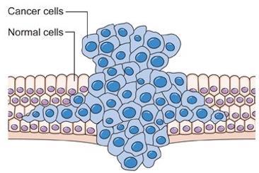 CANCER NOTES When control is lost and there is a mistake in the cell cycle: Cancer is an dividing of cells Cancer: A Mistake in the Cell Cycle?