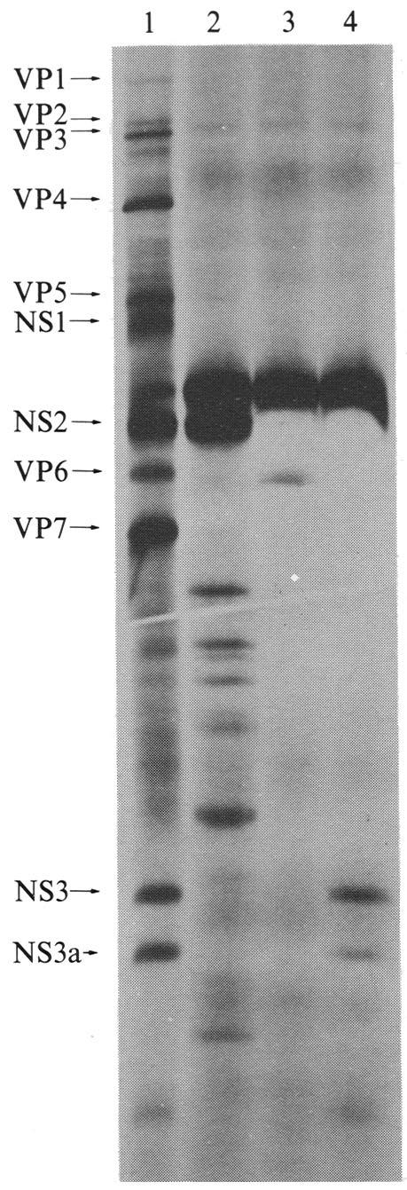 946 Short communication VP1-- VP2-- VP3 VP4~ 1 2 3 4 VP5 NSI~ NS2 VP6 VP7~ NS3~ NS3a- Fig. l. In vitro translation products of total BTV genome dsrna or individually purified RNA segments.